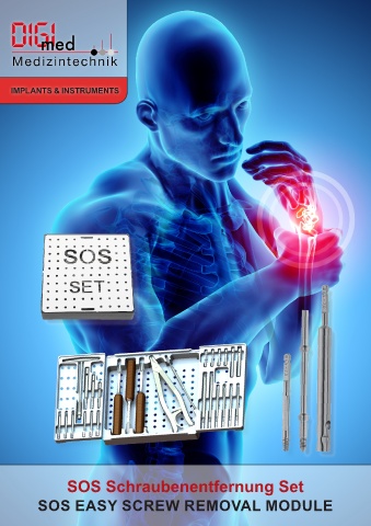 SOS ESR Tornillos Extracción de tecnología médica digimed de la ciudad médica mundial Tuttlingen